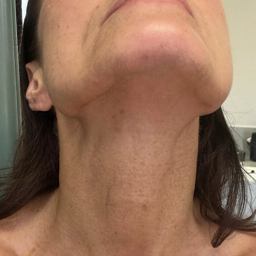 Nicole's neck skincare result