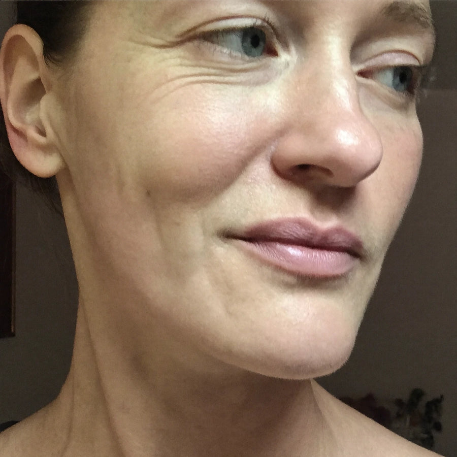 Brittany's face and neck skincare result